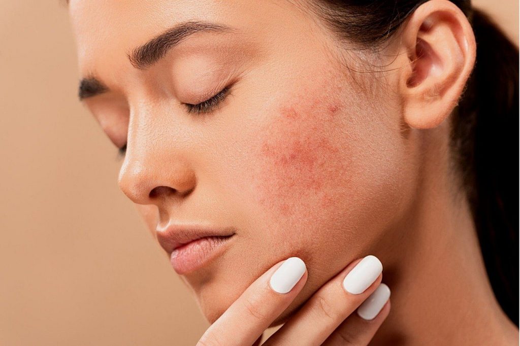 using-not-the-right-skincare-product